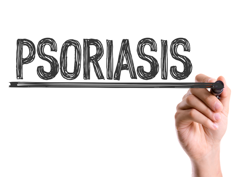 The Basic Facts about Psoriasis and How to Deal